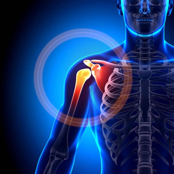 ⁦Épaulière de Compression Sportive – Soutien Léger pour Blessures et Prévention⁩ - الصورة ⁦3⁩